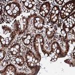 KIF18A Antibody in Immunohistochemistry (Paraffin) (IHC (P))