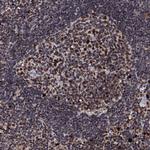 KIF18A Antibody in Immunohistochemistry (Paraffin) (IHC (P))