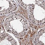 KIF18A Antibody in Immunohistochemistry (Paraffin) (IHC (P))