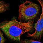 DAK Antibody in Immunocytochemistry (ICC/IF)