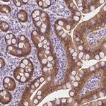 DAK Antibody in Immunohistochemistry (IHC)