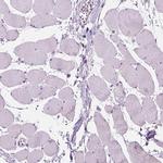 DAK Antibody in Immunohistochemistry (IHC)