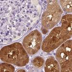 DAK Antibody in Immunohistochemistry (IHC)