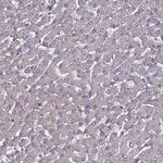 NCKAP1L Antibody in Immunohistochemistry (Paraffin) (IHC (P))