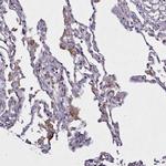 NCKAP1L Antibody in Immunohistochemistry (Paraffin) (IHC (P))