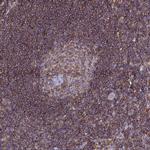 NCKAP1L Antibody in Immunohistochemistry (Paraffin) (IHC (P))