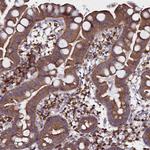 NCKAP1L Antibody in Immunohistochemistry (Paraffin) (IHC (P))