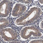 LOH12CR1 Antibody in Immunohistochemistry (Paraffin) (IHC (P))