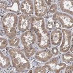 LOH12CR1 Antibody in Immunohistochemistry (Paraffin) (IHC (P))