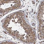 LOH12CR1 Antibody in Immunohistochemistry (Paraffin) (IHC (P))