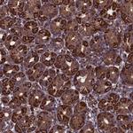 MYO1H Antibody in Immunohistochemistry (Paraffin) (IHC (P))