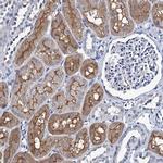 MIOX Antibody in Immunohistochemistry (IHC)