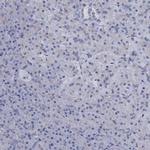 MIOX Antibody in Immunohistochemistry (IHC)