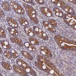 SACM1L Antibody in Immunohistochemistry (Paraffin) (IHC (P))