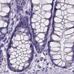 SPEF2 Antibody in Immunohistochemistry (IHC)