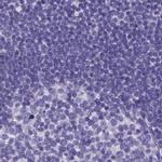 SPEF2 Antibody in Immunohistochemistry (IHC)