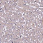 NCAPG Antibody in Immunohistochemistry (Paraffin) (IHC (P))