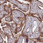 NCAPG Antibody in Immunohistochemistry (Paraffin) (IHC (P))