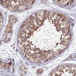 NCAPG Antibody in Immunohistochemistry (Paraffin) (IHC (P))