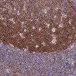 NCAPG Antibody in Immunohistochemistry (Paraffin) (IHC (P))