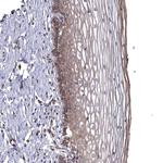 WDR19 Antibody in Immunohistochemistry (Paraffin) (IHC (P))