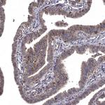 WDR19 Antibody in Immunohistochemistry (Paraffin) (IHC (P))