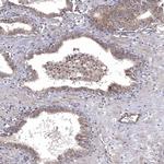 WDR19 Antibody in Immunohistochemistry (Paraffin) (IHC (P))