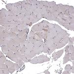 WDR19 Antibody in Immunohistochemistry (Paraffin) (IHC (P))