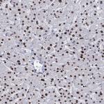 DCPS Antibody in Immunohistochemistry (Paraffin) (IHC (P))