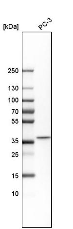 DCPS Antibody in Western Blot (WB)