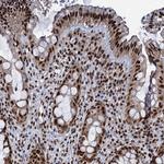 RPUSD4 Antibody in Immunohistochemistry (IHC)