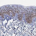 RPUSD4 Antibody in Immunohistochemistry (IHC)