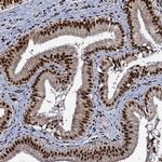 RPUSD4 Antibody in Immunohistochemistry (IHC)