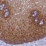 ADH7 Antibody in Immunohistochemistry (IHC)