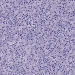 ADH7 Antibody in Immunohistochemistry (IHC)