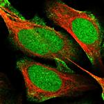 MPP8 Antibody in Immunocytochemistry (ICC/IF)