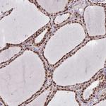 MPP8 Antibody in Immunohistochemistry (IHC)