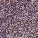 MPP8 Antibody in Immunohistochemistry (IHC)