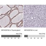 MPP8 Antibody