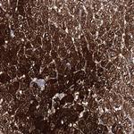 AMDHD1 Antibody in Immunohistochemistry (Paraffin) (IHC (P))