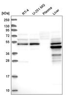 AMDHD1 Antibody in Western Blot (WB)