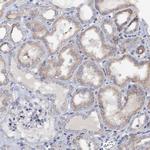 VPS36 Antibody in Immunohistochemistry (Paraffin) (IHC (P))