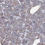 VPS36 Antibody in Immunohistochemistry (Paraffin) (IHC (P))