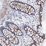 VPS36 Antibody in Immunohistochemistry (Paraffin) (IHC (P))