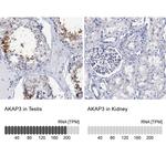 AKAP3 Antibody in Immunohistochemistry (IHC)