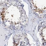 AKAP3 Antibody in Immunohistochemistry (IHC)