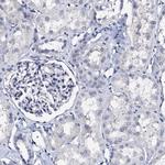 AKAP3 Antibody in Immunohistochemistry (IHC)