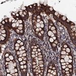 MTIF3 Antibody in Immunohistochemistry (Paraffin) (IHC (P))