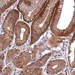 SVIP Antibody in Immunohistochemistry (Paraffin) (IHC (P))