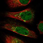 BET1L Antibody in Immunocytochemistry (ICC/IF)